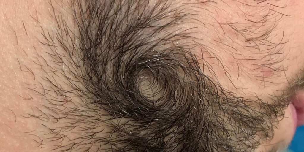 The Spiraling Beard Cowlick Tips To Get