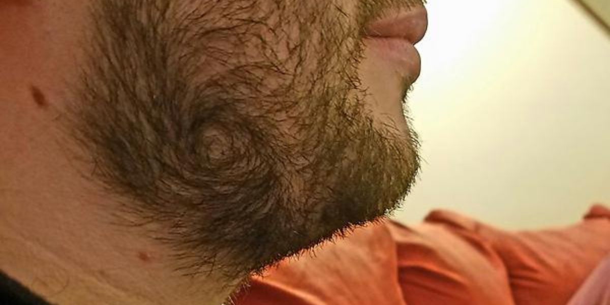 The Spiraling Beard Cowlick Tips To Get