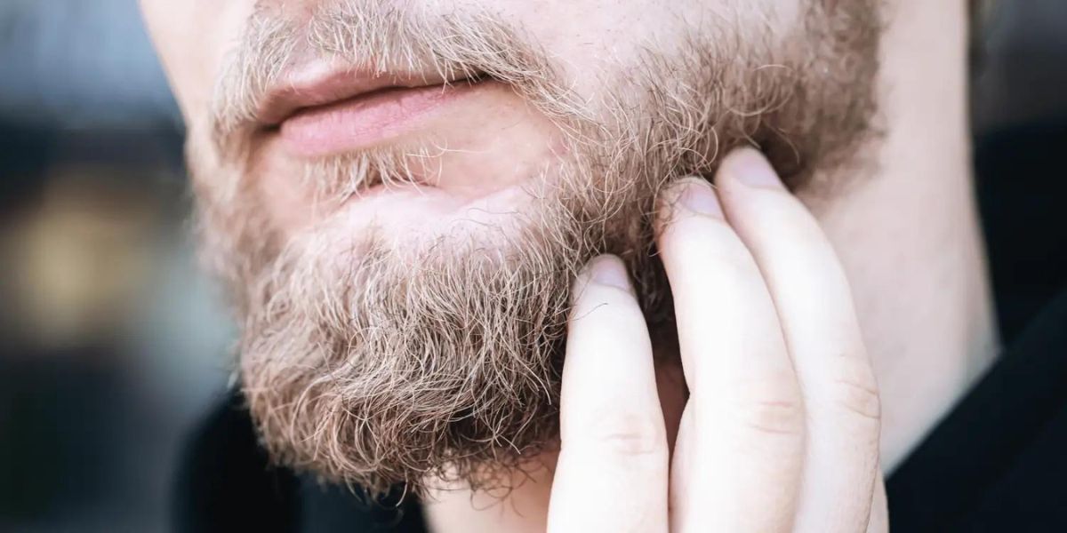 Why My Beard Itch And How To Stop 